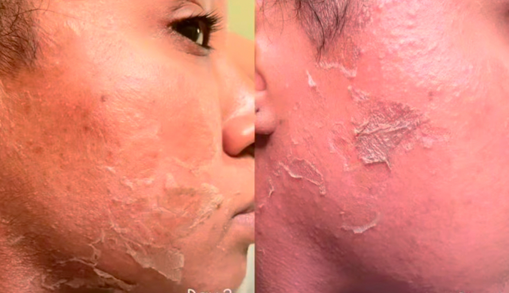 The Real Deal Peel