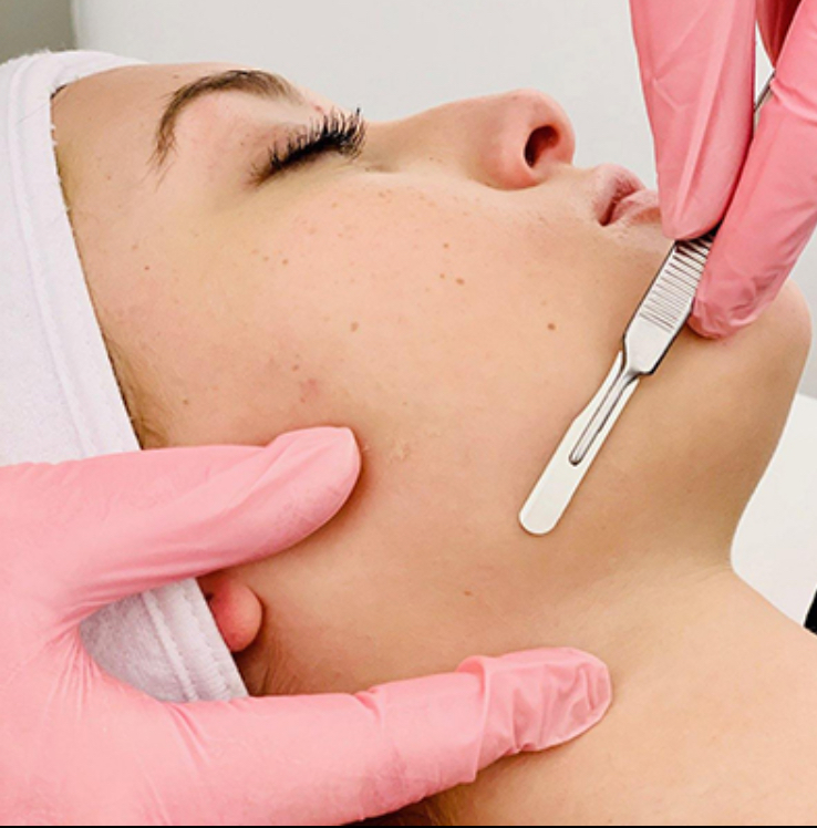 Dermaplaning