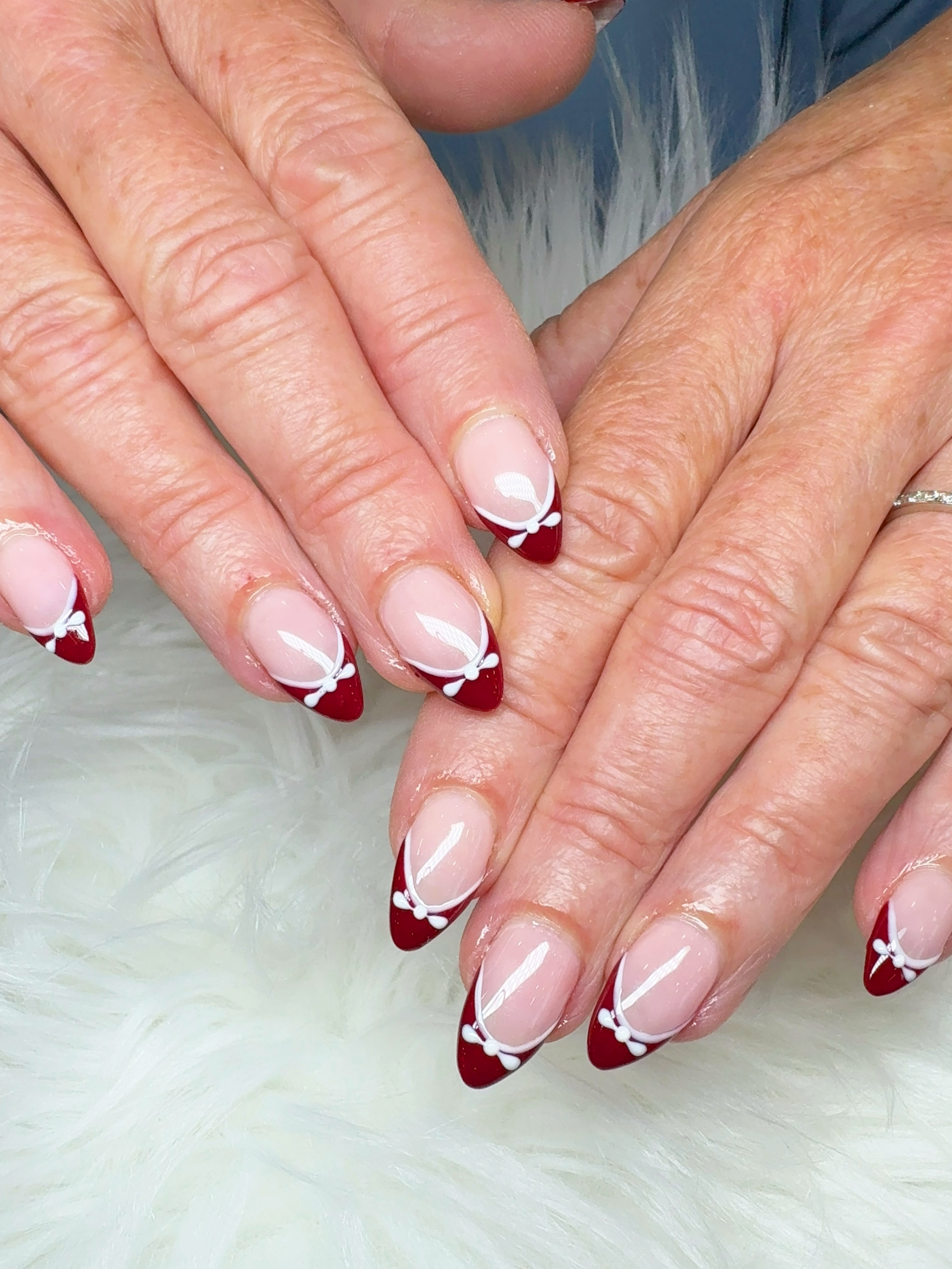 IBD hard gel fill-in