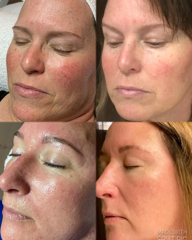 Embrace The MADness Facial