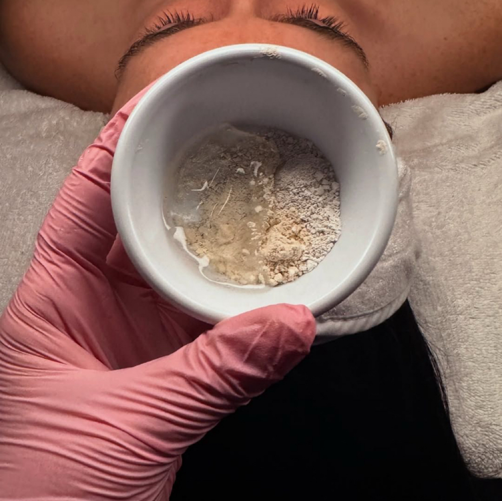 Customized Acne Treatment at Sukoon Studio in Richardson, TX