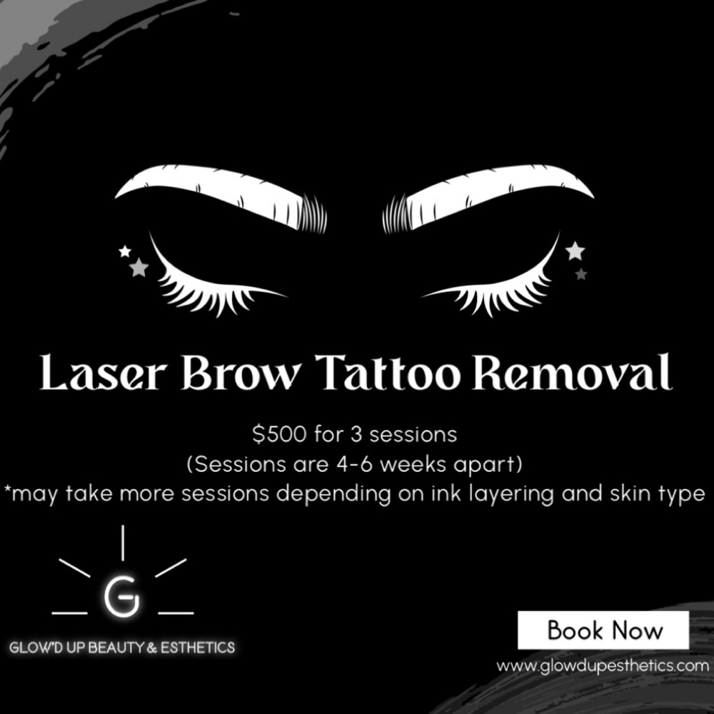 Picolazer Brow Tattoo Removal at Glow’d Up Beauty & Esthetics in Pikeville, KY