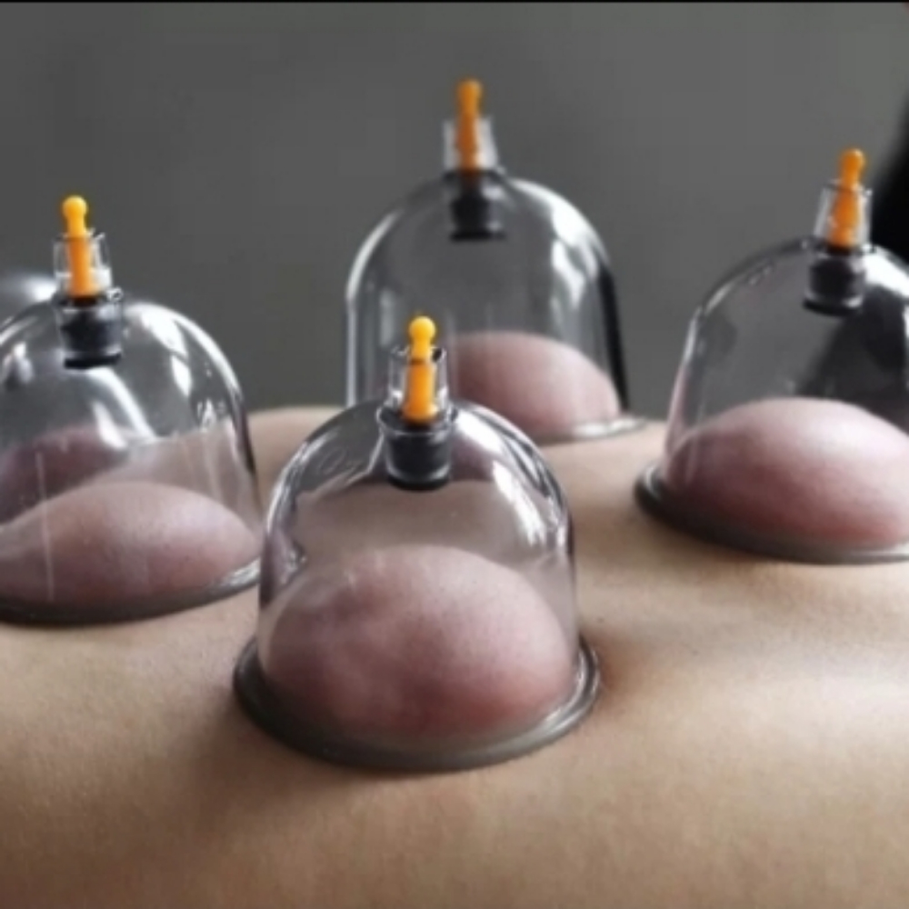 Cupping Therapy at Aligned Massage & Wellness in Shenandoah, IA