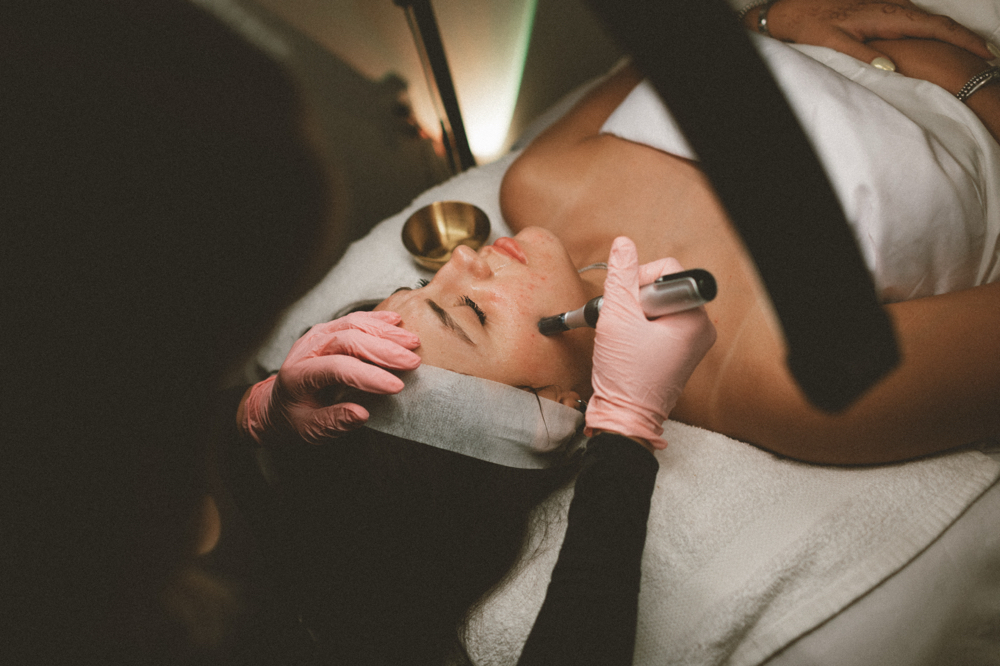 Golden Microneedling at Golden Skin Bar in Mesa, AZ