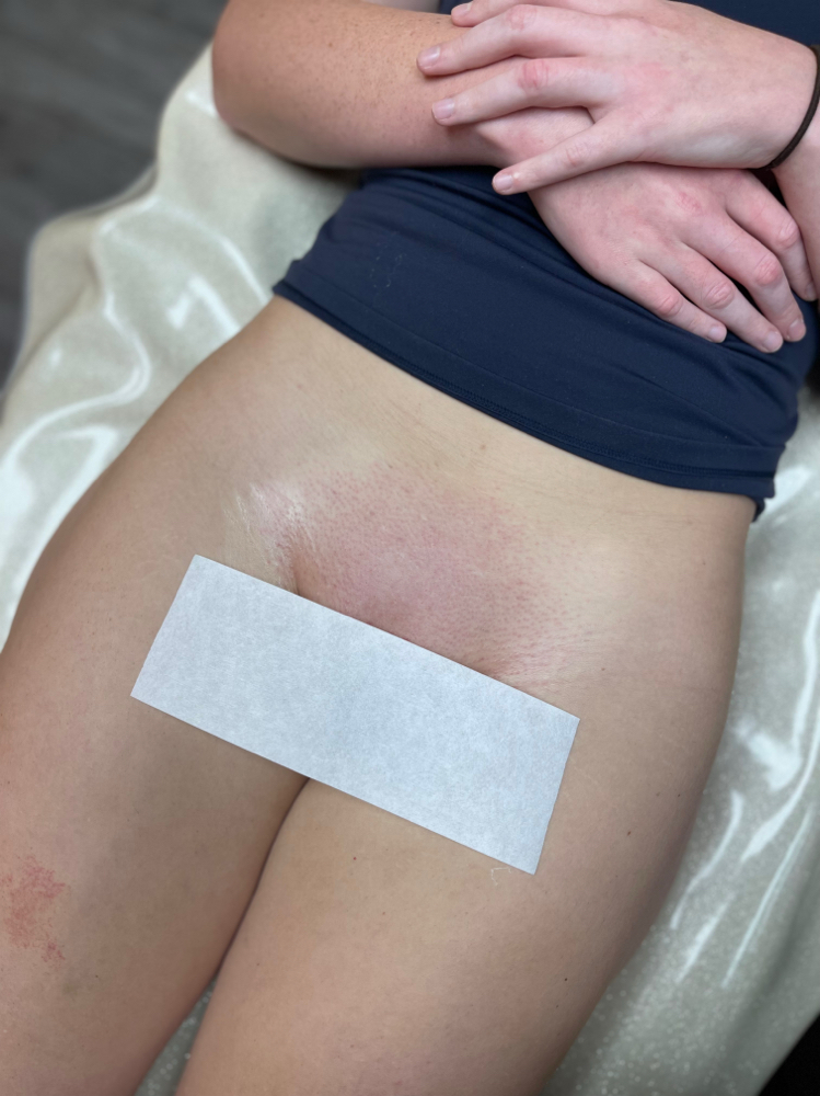 Brazilian & Lip & Underarm Wax