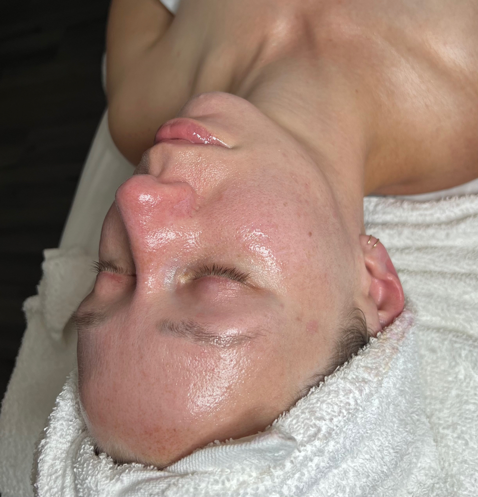 Dermaplane Facial