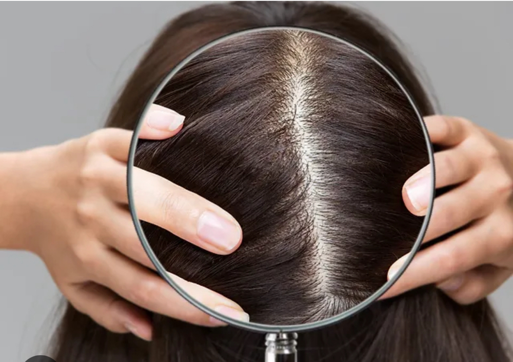Consultation (Hair Analysis)