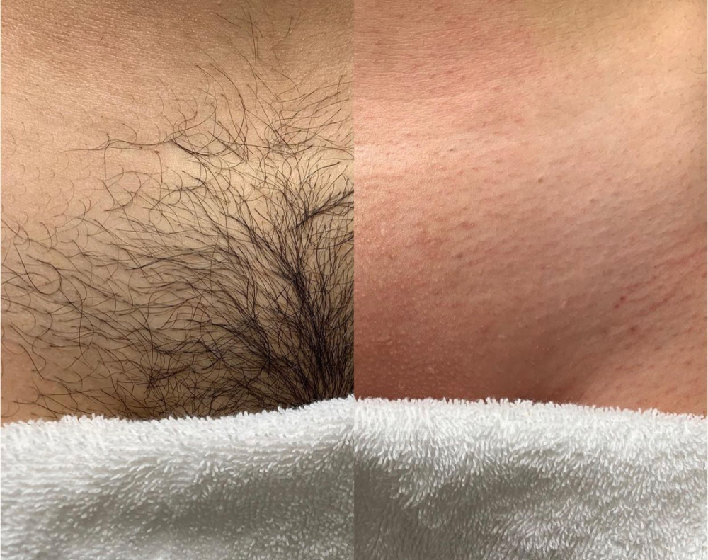 Sugar Wax Brazilian SPECIAL