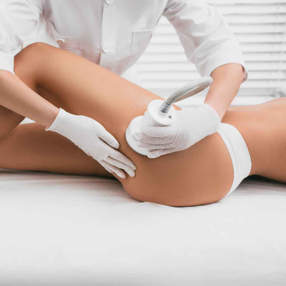 Cavi Lipo (Ultrasonic Cavitation)