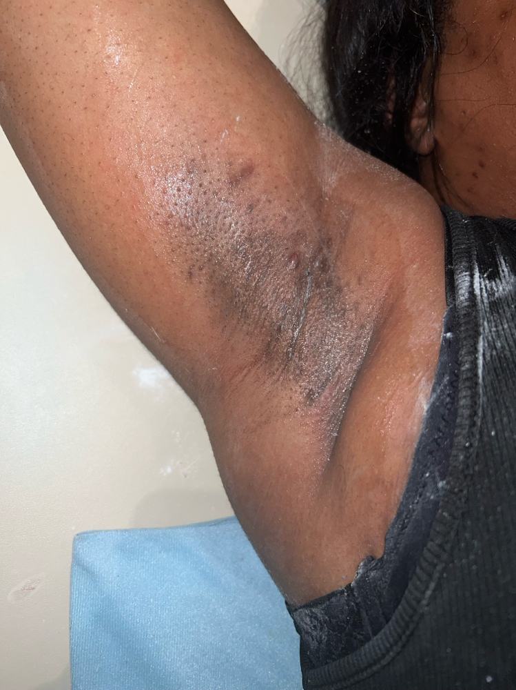 Underarm wax at Nessie_The_Esthie in Kingston, TN