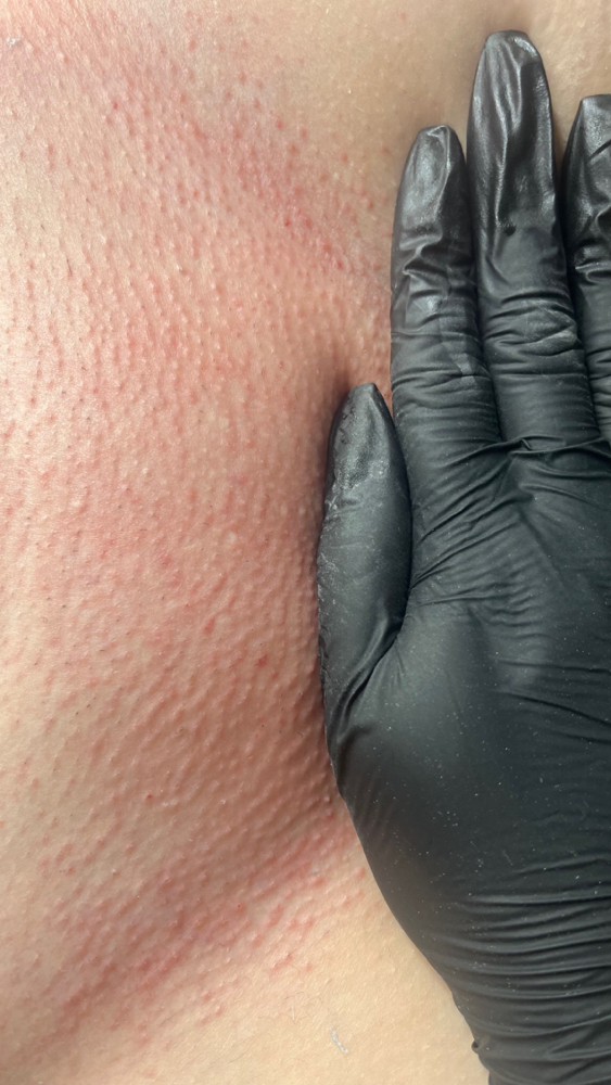 Brazilian Wax