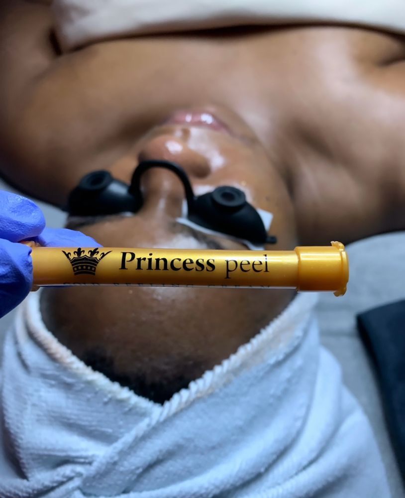 Inflacure Acne+ Treatment