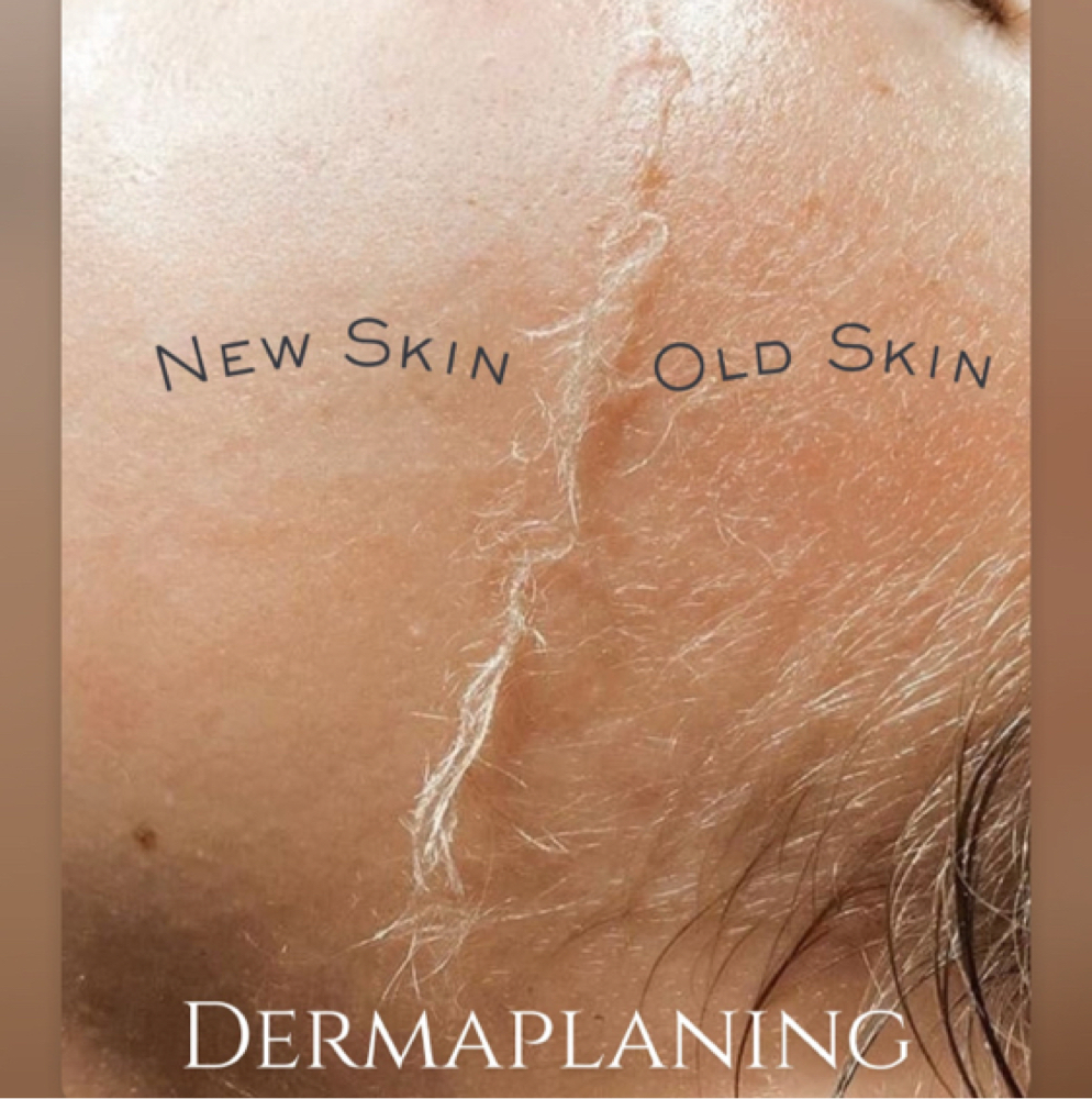 🍒Cherry Smooth: The Express at CherryBottoms Aesthetics in Reno, NV