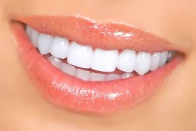 Luminous Lift Teeth Whitening
