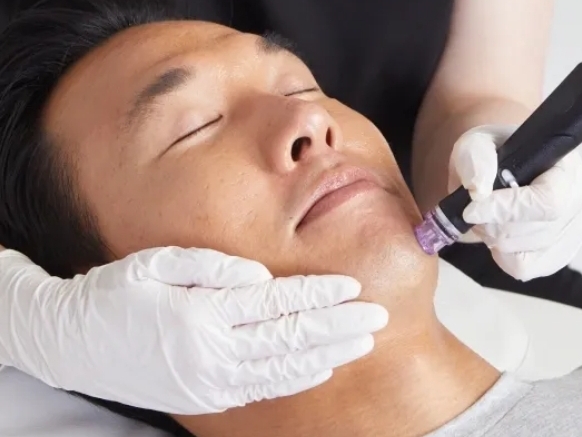 The Deep Purity Hydrafacial