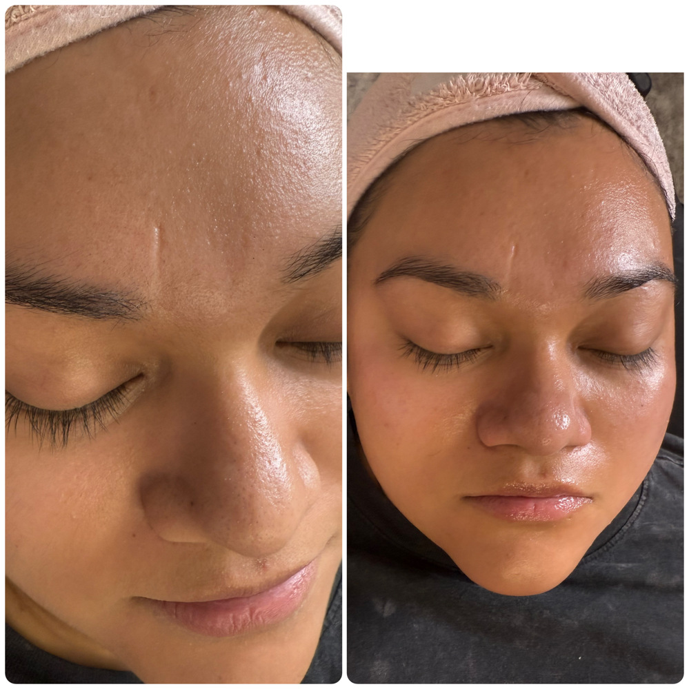 Mini Glo Facial
