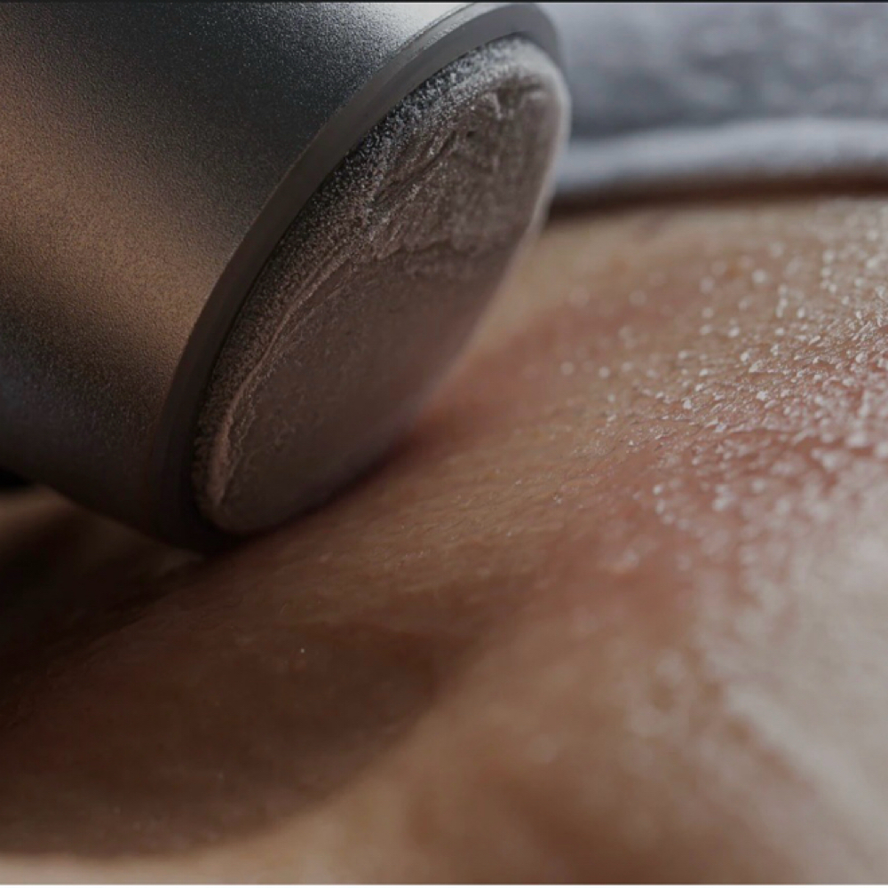 Cryotherapy — the power of cold for at Viva Viktoriya LLC in Boca Raton, FL