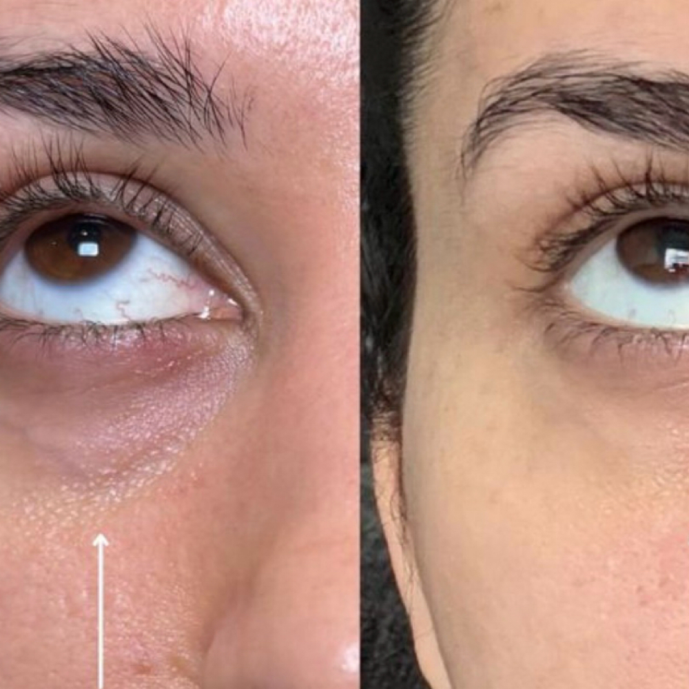 ✨Rejuvanating Eye Therapy✨ at Dream Glow in Hart, TX