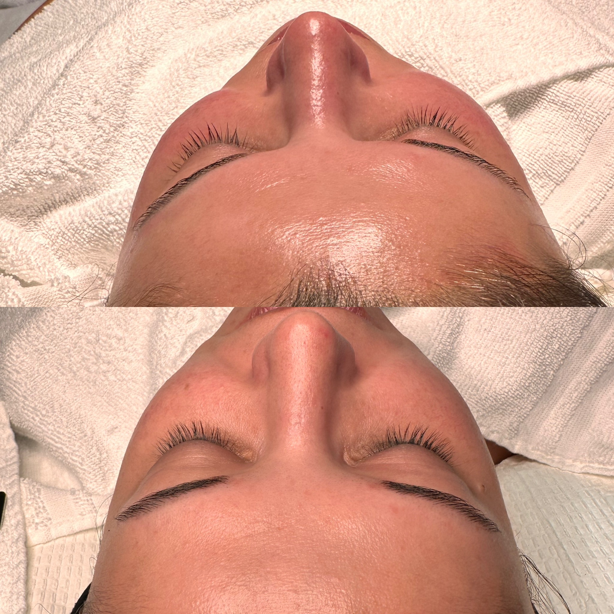 HydraFacial at Pop Beauty Studio in Torrance, CA