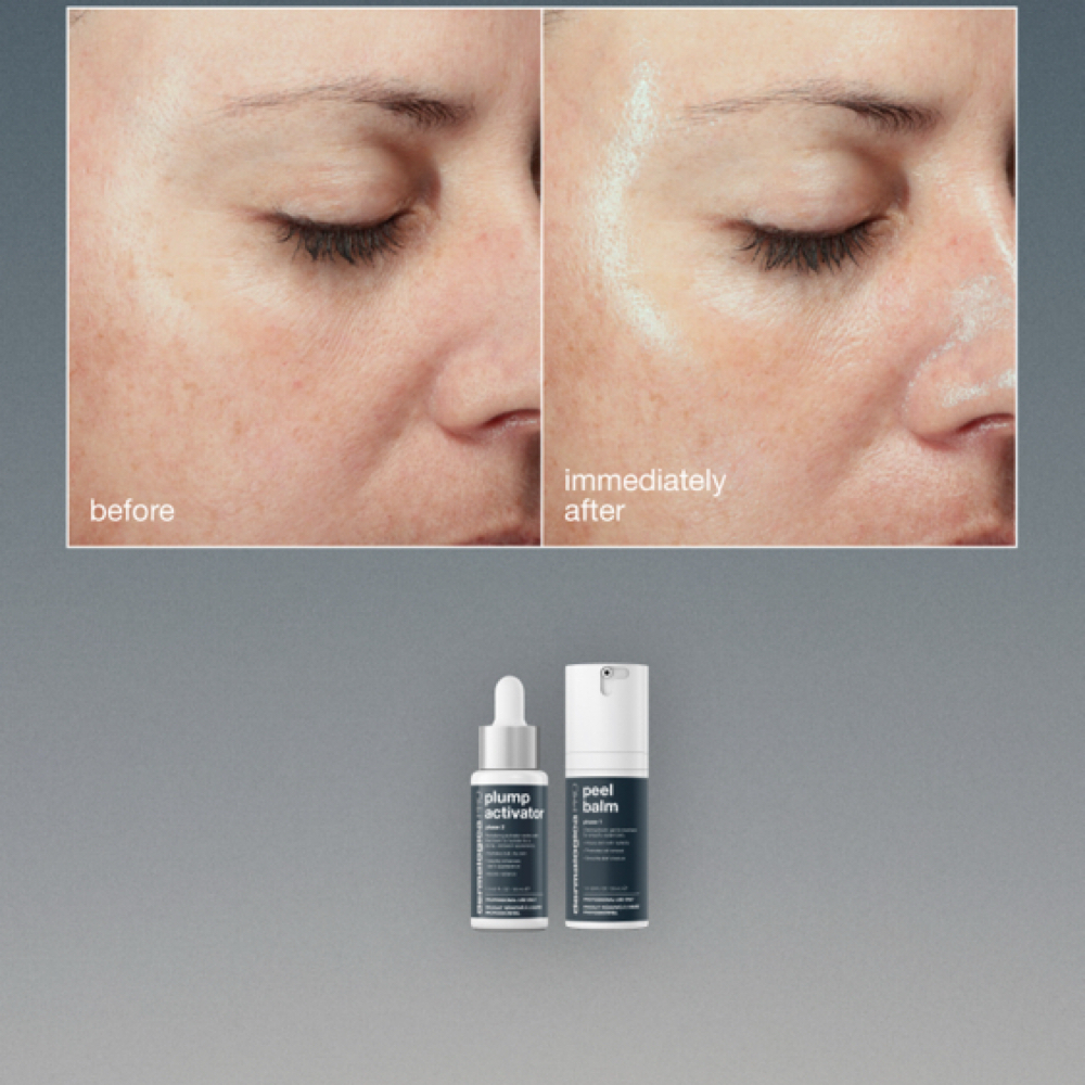 Luminfusion X Plump Peel at Uniqla Beauty Lounge in Painesville, OH