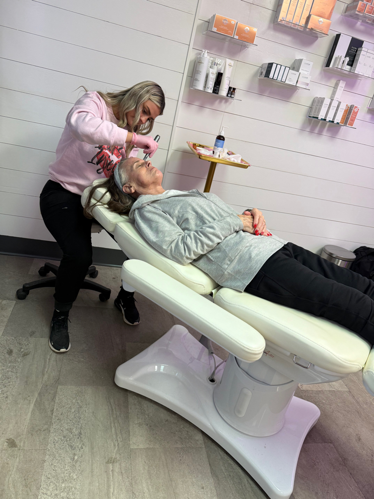 MICRONEEDLING