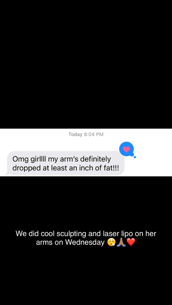 Cool sculpting at MarriGLoW in Sharon, PA
