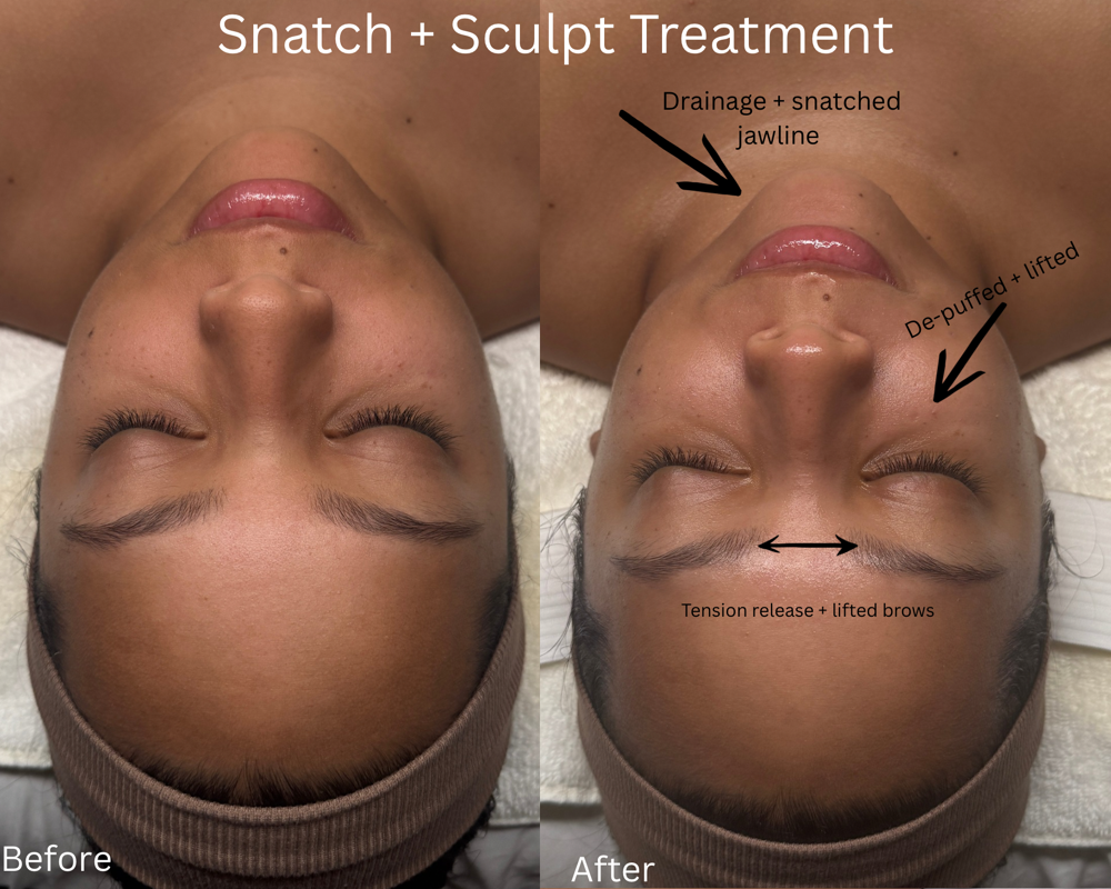Lift + Sculpt Lympatic Facial