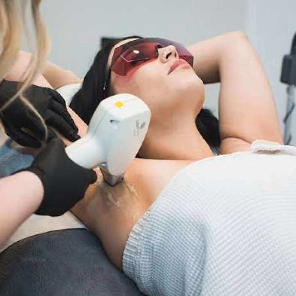Laser Hair Removal- Underarms at Chatuge Med Spa & Fitness in Hiawassee, GA
