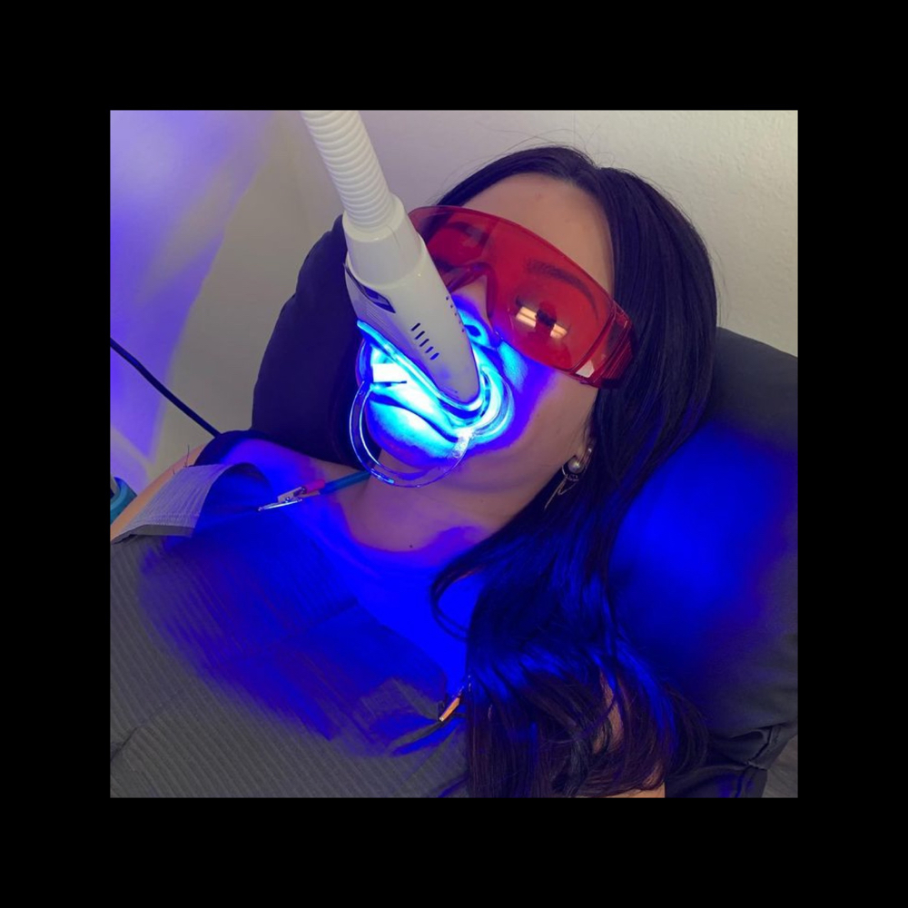 ✨Supreme White + at Whitening Bliss✨🦷✨ in San Jose, CA