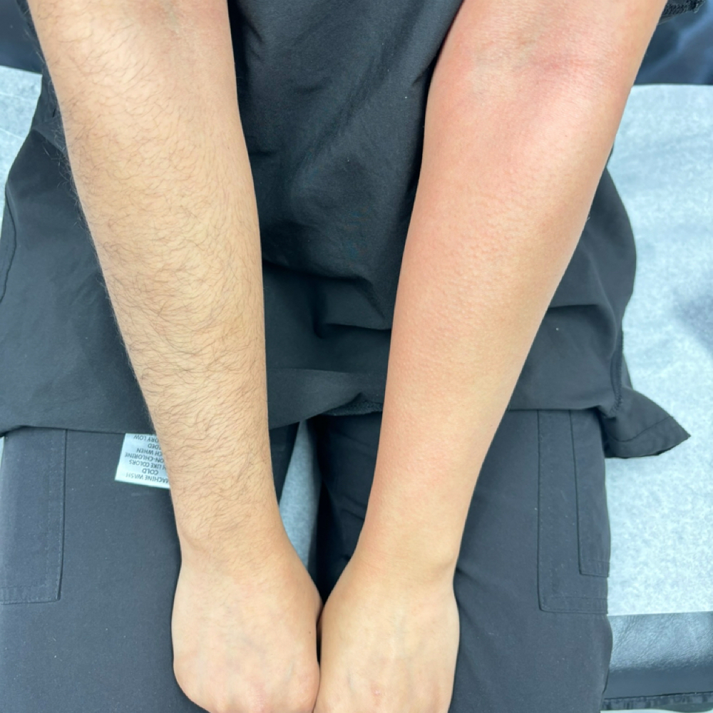 Half Arm at Ama Aesthetics Studio in Methuen, MA