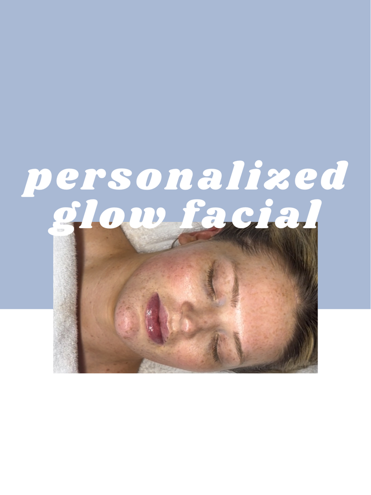 Personalized Glow Chemical Peel