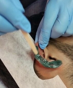 Waxing Earlobe
