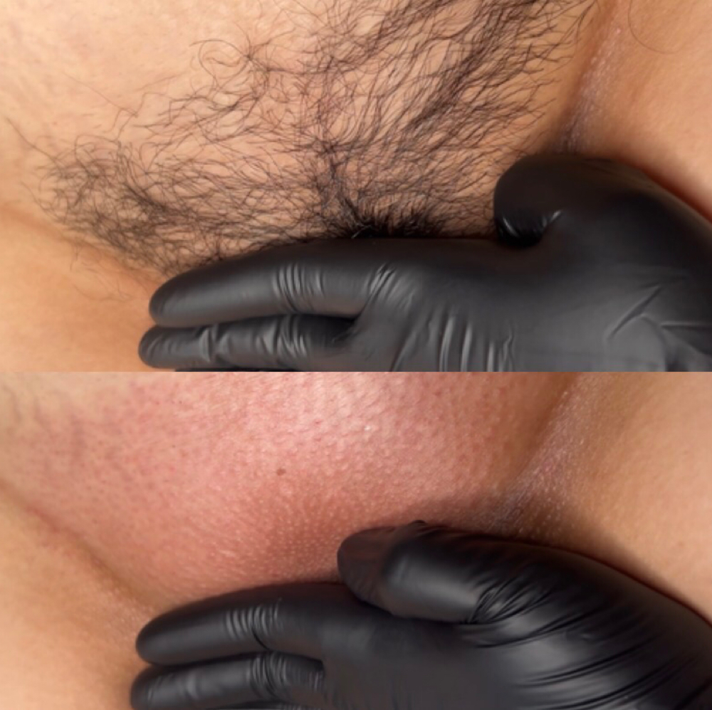 Brazilian (Front + Back) at Beauty Ink Studio in Corpus Christi, TX