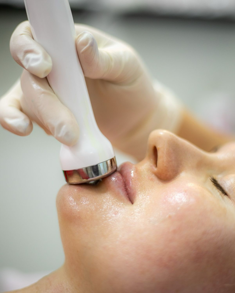 Ultrasound tightening add on