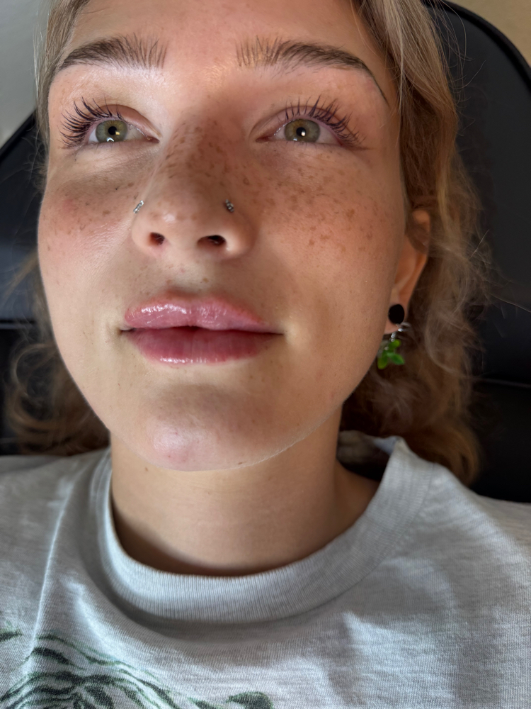 Lip Refresh 0.5ML at Palméra Aesthetics in Killeen, TX