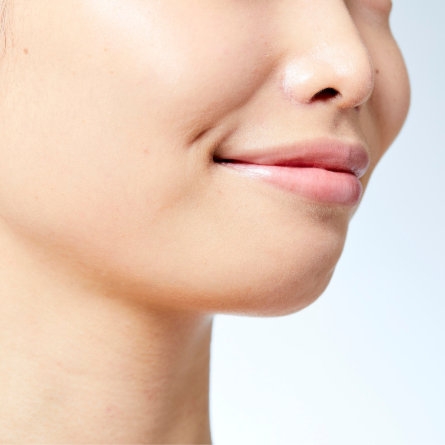 Kybella - 3 Vials at DM Laser Skin Care Solutions in Needham, MA