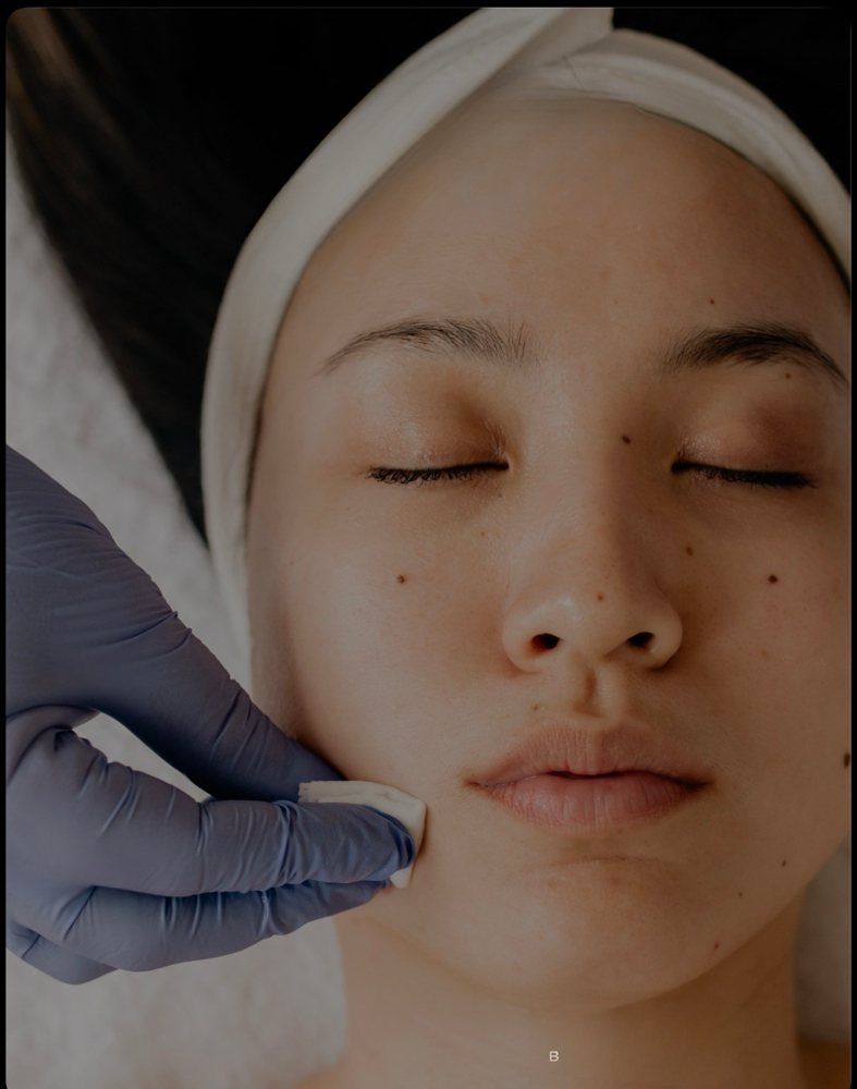 Level I – The Lavish Glow Peel