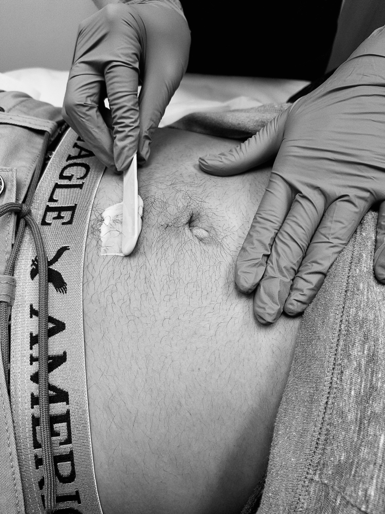 Blasian Stomach Wax