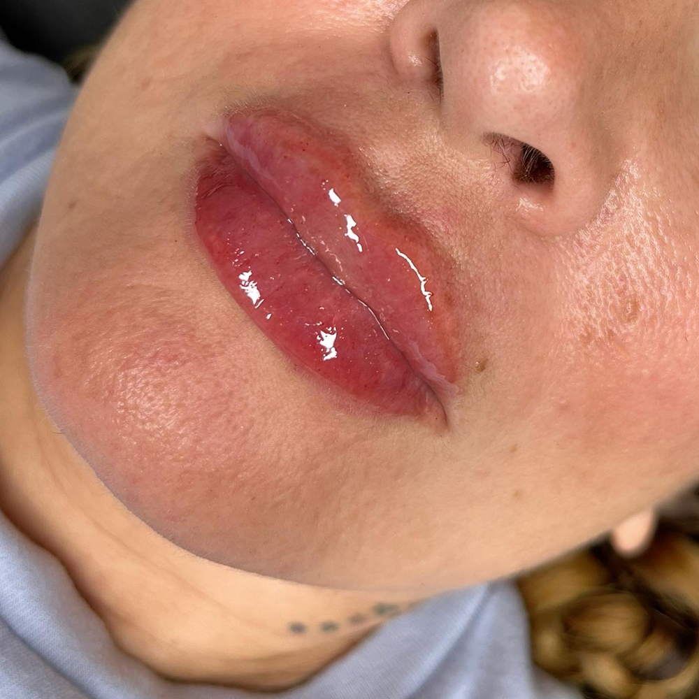 Juicy Lips Package