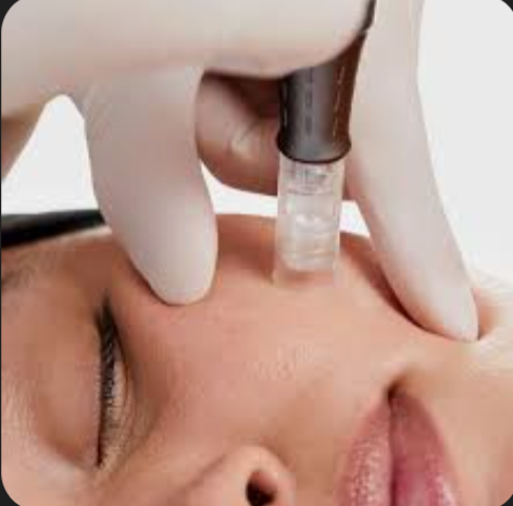 Nano Needling FULL FACE