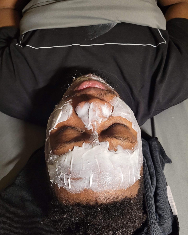 Chemical Peel