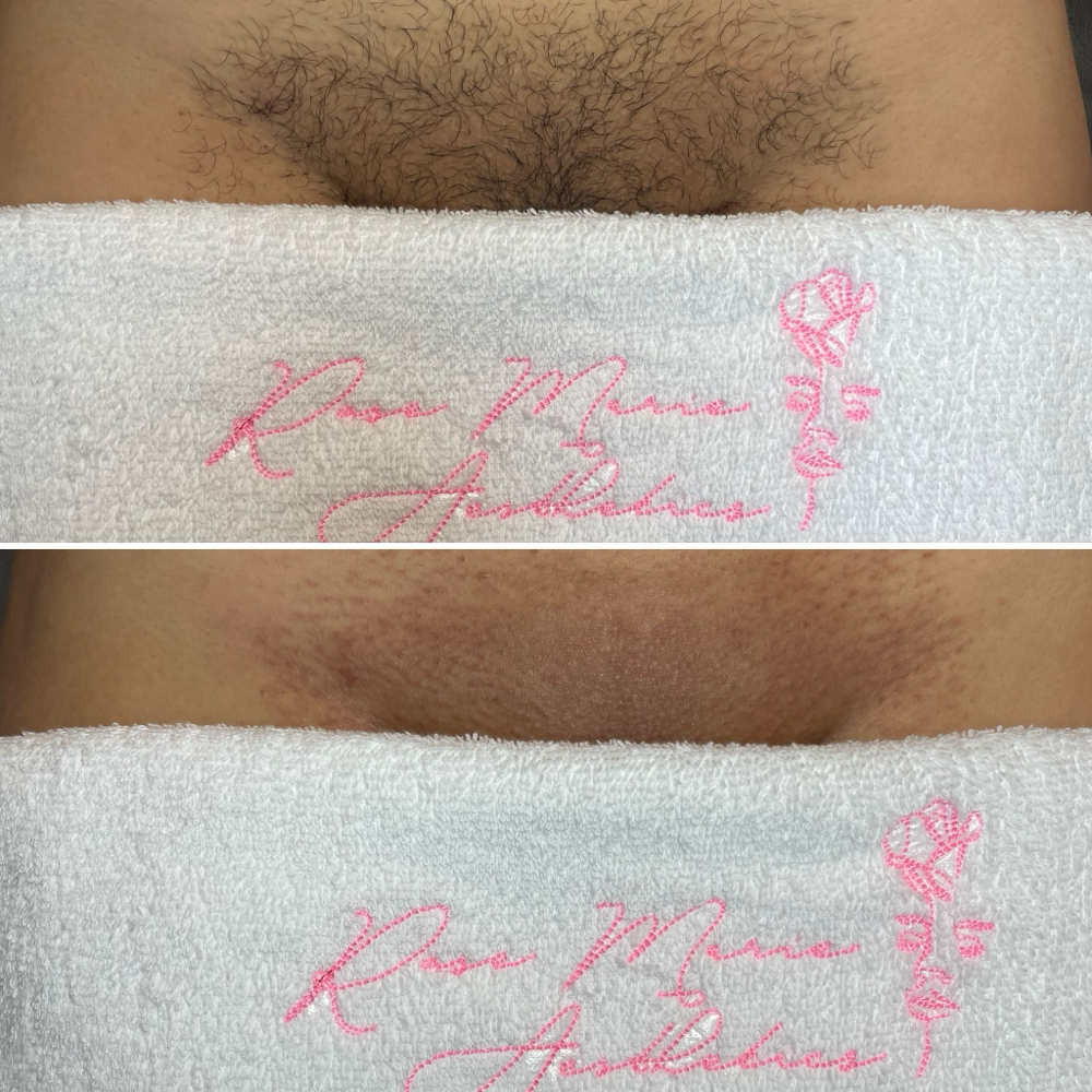 Brazilian Wax