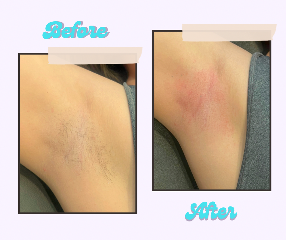 Underarms Waxing