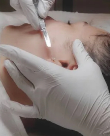 Dermaplane