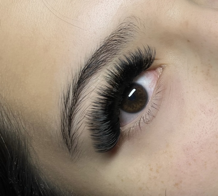 Regular Volume Set at Ashxsthetics in Naples, FL