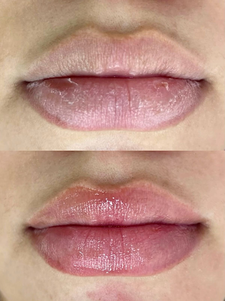 Hydra Lips at Beauty Studio Jenny LLC in Meredith, NH