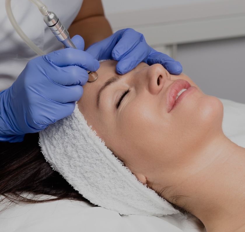 Add On  (Microdermabrasion)