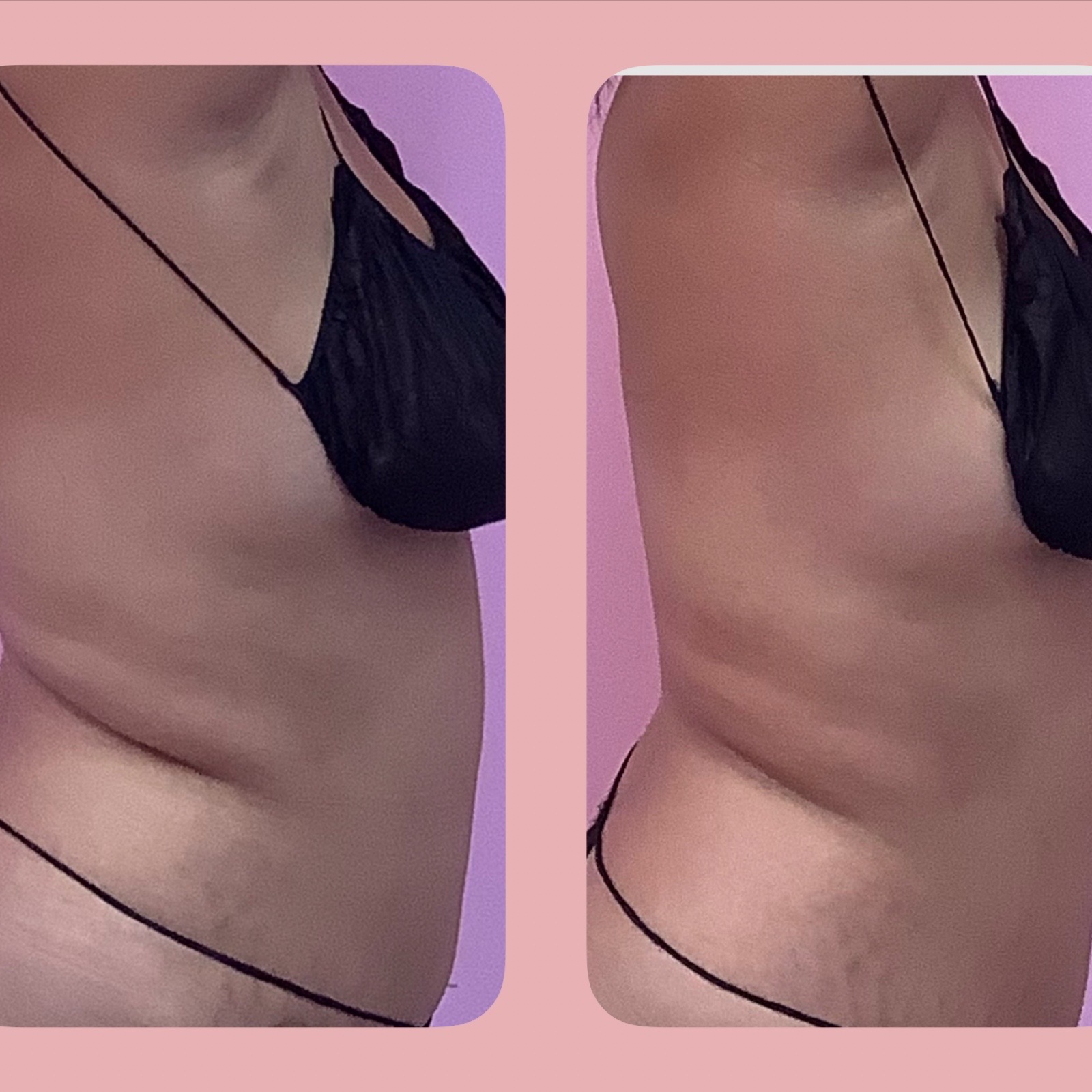 1 Body sculpting deluxe at Infinity Beauty BlancaG in Denton, TX