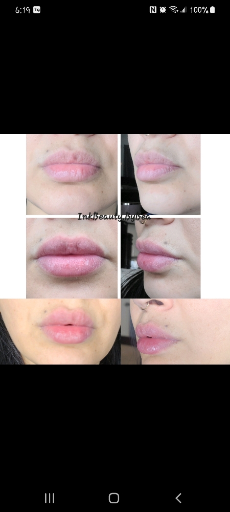 Savory Beauty Lip 3sessions 2.ml