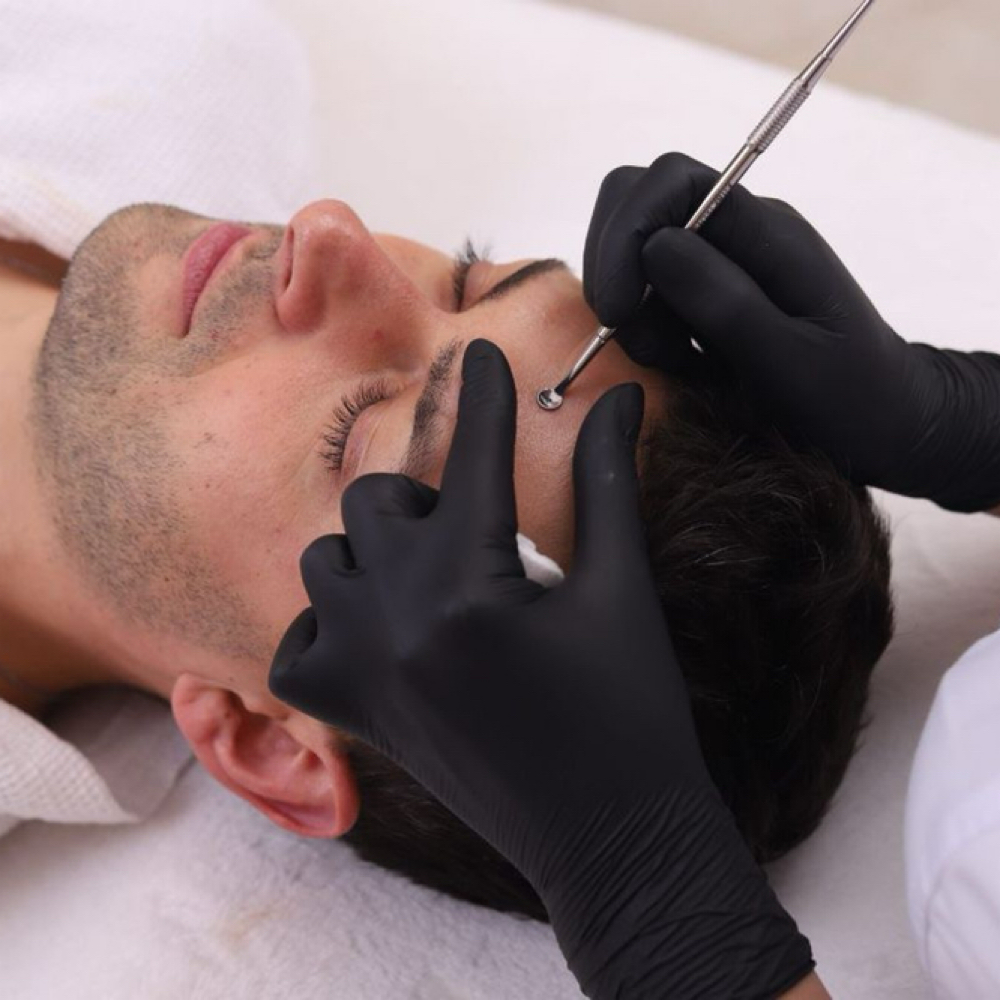 Deep Cleansing Facial at Skin_beauty_ca in Walnut Creek, CA